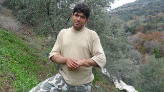 Tıp tarihine geçmişti! Kendim 39 yaşındayım, kollarım ise 12 yaşında