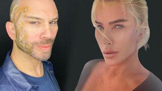 Estetik yaptıran Berksan: Seda Sayan’ın kardeşi olmayı...