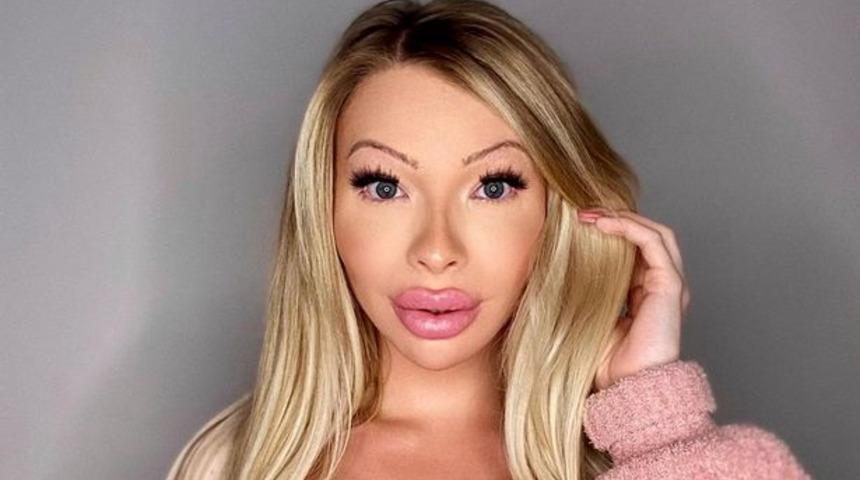 Estetik ameliyat bağımlısı Serena Smith, görünümü için milyonlarca dolar harcadı! “Erkekler trafiği durdurup bana...”