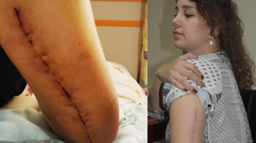 Kolunu sevgilisi kırmıştı! Yaşadığı dehşet anlarını böyle anlattı: Arabamda buluştuk, üzerime çıktı