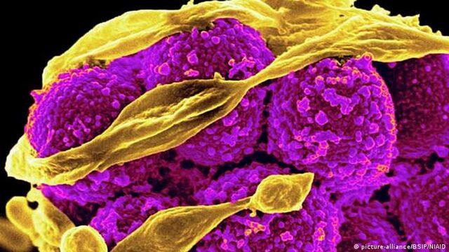 Araştırma: Antibiyotik direnci kaynaklı ölümler artıyor