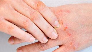 Anında azalıyor! Bu görüntüye günler içinde veda edeceksiniz