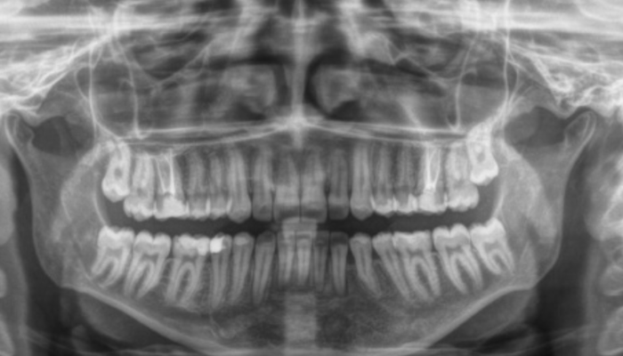 Eskişehir'de diş dolgusu yaptırmak isteyen kadın dişçi koltuğunda hayatının şokunu yaşadı