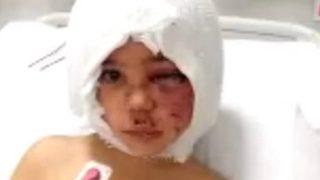 Pitbull saldırısına uğrayan Asiye'den haber var! Prof. Dr. Ömer Özkan, ''İlk defa gördüm'' diyerek açıkladı