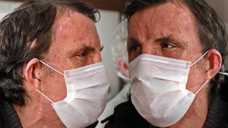 Türkiye'nin ilk yüz naklinin üzerinden 10 yıl geçti! İşte Uğur Acar'ın son hali