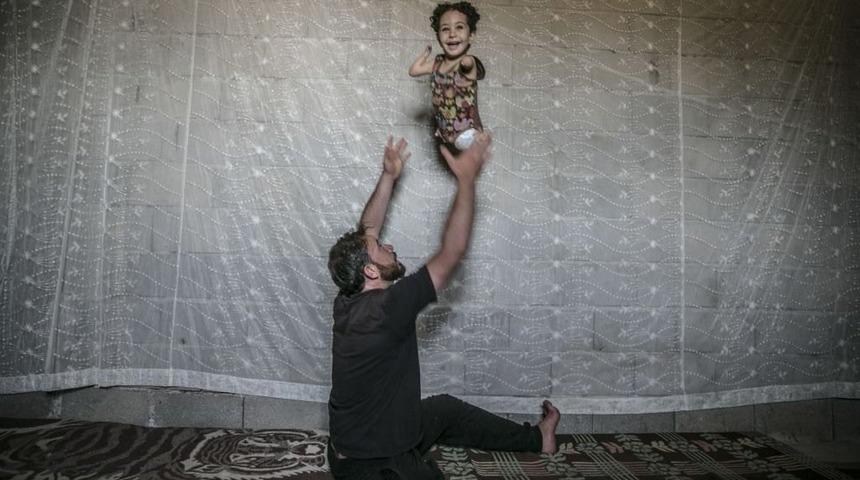 Suriye'de yaralanıp sakat kalan baba ve engelli doğan oğlu İtalya'da tedavi edilecek: 'Bir fotoğraf fark yarattı'