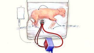 Çok erken doğan bebekler için yeni umut: Yapay rahim