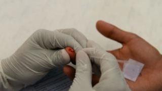 Araştırma: HIV virüsü kapan biri artık 78 yaşına kadar yaşayabilir