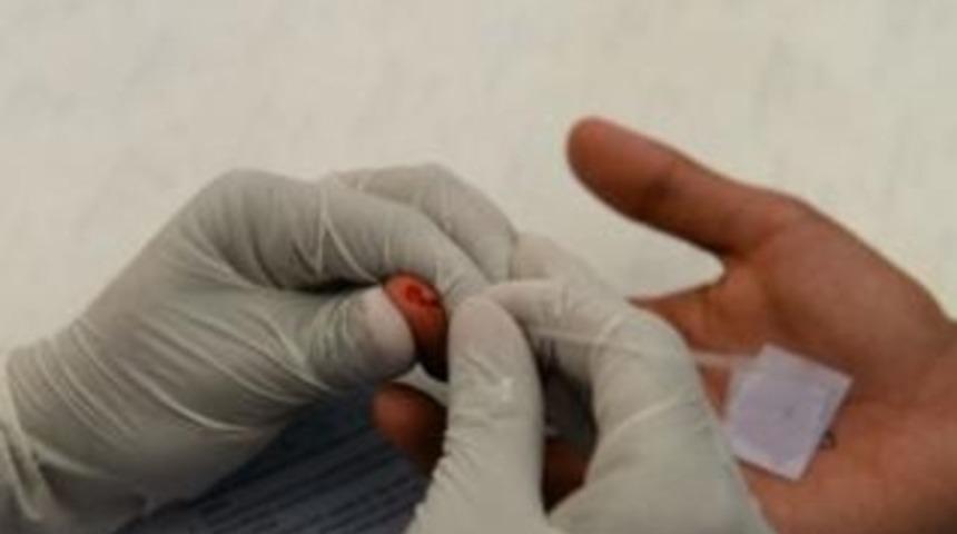 Araştırma: HIV vir&uuml;s&uuml; kapan biri artık 78 yaşına kadar yaşayabilir