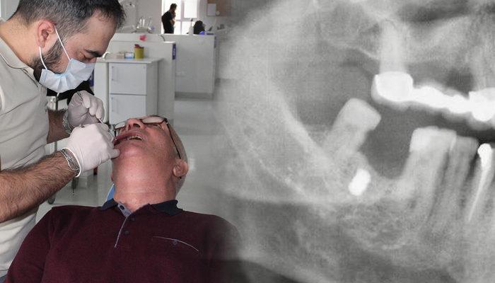 Diş tedavisi için doktora gitti, görünce şaşkına döndüler! 15 yıl boyunca...