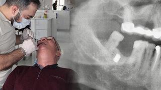 Diş tedavisi için doktora gitti, görünce şaşkına döndüler! 15 yıl boyunca...