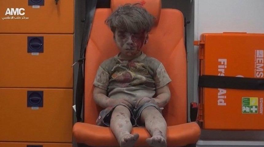 Saldırıda yaralanan çocuğun ambulanstaki fotoğrafı güne damgasını vurdu