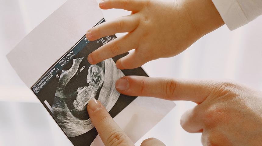 Kulaktan kulağa dolaşan efsanelere inanmayın: İşin gerçeği bu! Cinsiyeti belirleyen etkin güç...