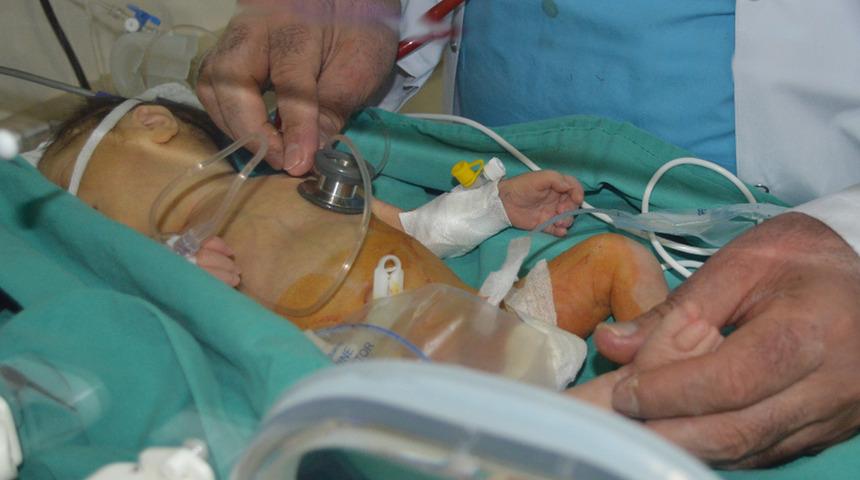 5 binde bir g&ouml;r&uuml;l&uuml;yor! Makatı olmadan doğdu