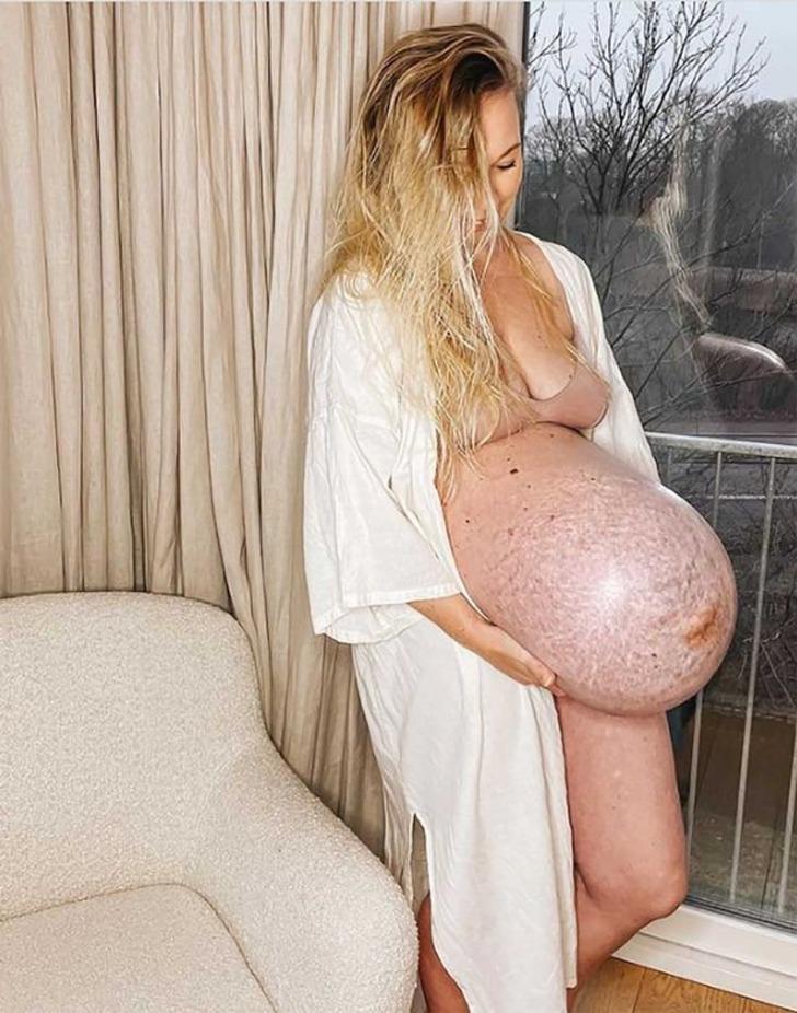 Hamilelik süreci sosyal medyada fenomen oldu! Görenler göbeğinin büyüklüğüne inanamadı