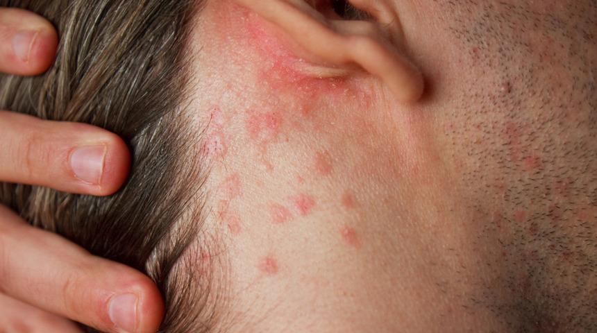 Virüs gündemde ama pandemide bu hastalıklar aldı başını gitti!