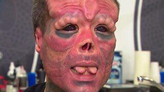 Marvel’in kötü karakterine benzemek için sayısız operasyon geçirdi! Son hali herkesi ürküttü