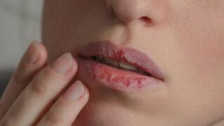 Ağız kuruluğunu hafife almayın! Başınıza çok dert açabilir