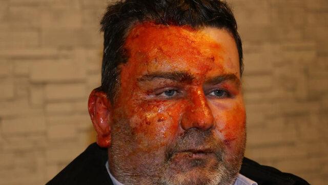 3 çocuk babası uyurken dehşeti yaşadı! Uyandığında şoke oldu: Oh ne iyi yaptım