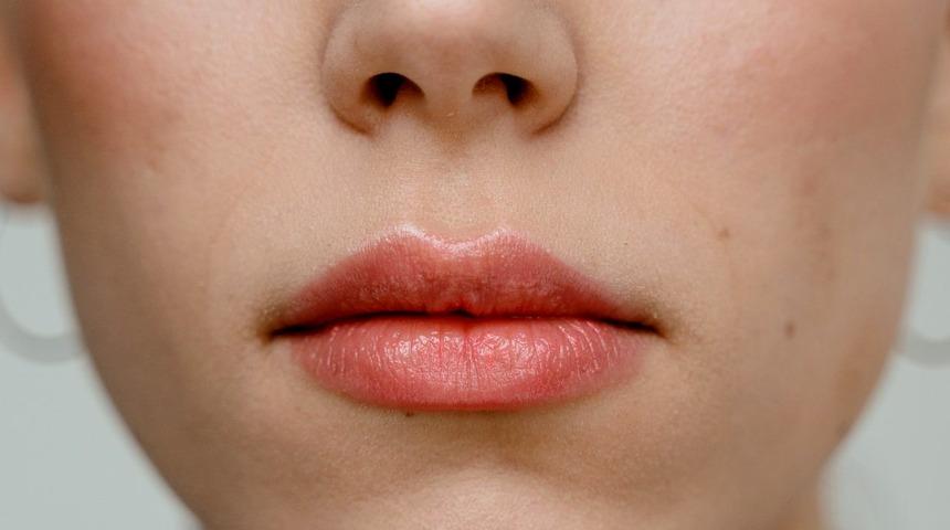 Dudak &ccedil;evresindeki kırışıklıklardan rahatsız olanları buraya alalım!