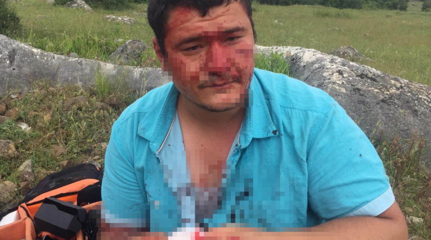 Lütfü Türkkan'ın çiftliğinin yıkımı sırasında saldırıya uğramıştı! İHA muhabiri Mustafa Uslu konuştu: Kalıcı olduğu kesinleşti