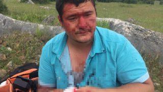 Lütfü Türkkan'ın çiftliğinin yıkımı sırasında saldırıya uğramıştı! İHA muhabiri Mustafa Uslu konuştu: Kalıcı olduğu kesinleşti