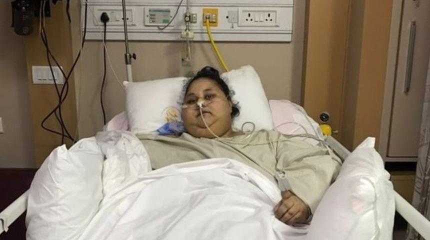 D&uuml;nyanın en kilolu kadını ameliyatla 100 kilo verdi