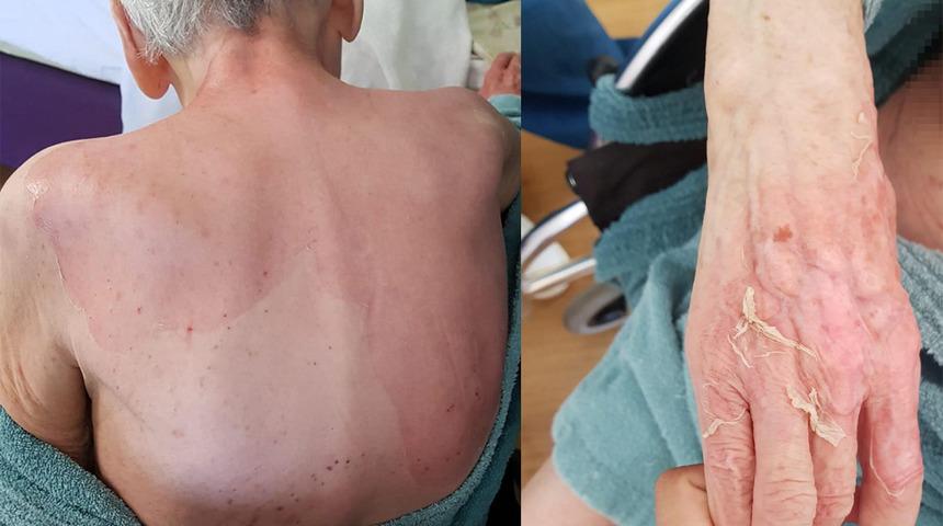 "Siyah siyah deri parçaları vardı" Huzurevinde korkunç olay! Banyo sonrası...