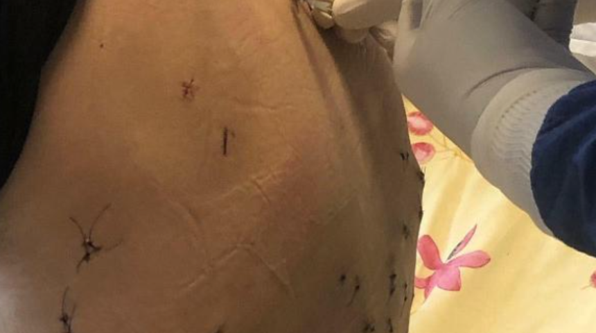 Gen&ccedil; kadın, ''Hen&uuml;z &ccedil;ok erken'' deyip teklifi kabul etmedi! 38 yerinden bı&ccedil;aklandı