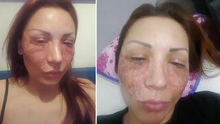 Bulgar modelin estetik kabusu! Kuaförde örümcek ağı estetiği yaptırdı, hayatının şokunu yaşadı