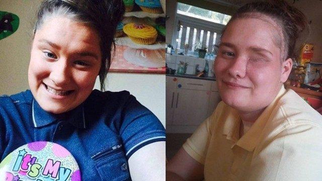 Dişi için gitti, gözü alındı