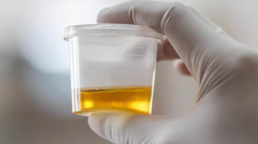 İdrarla yüz silmek! İnanılmaz tedavi yöntemi