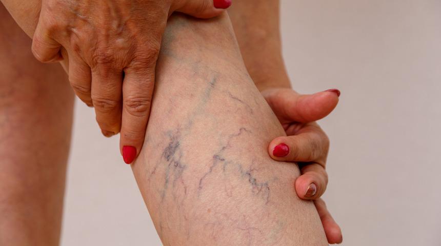 Uzmanından anne adaylarına uyarı: Varisiniz varsa tedavi olmayın