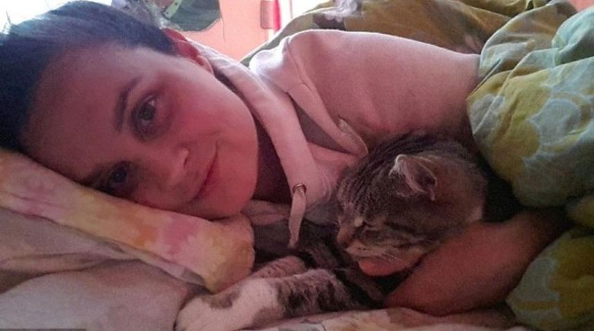 Günde 22 saat uyuyor: 'Uyuyan güzel' hastalığı işinden etti