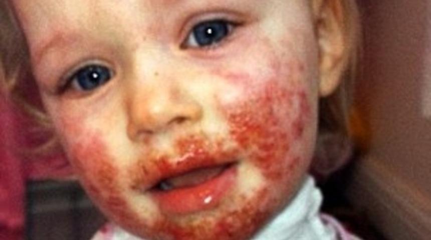 Küçük kızı ailesi dudağından öptü: Etleri canlı canlı 'yeniyor'