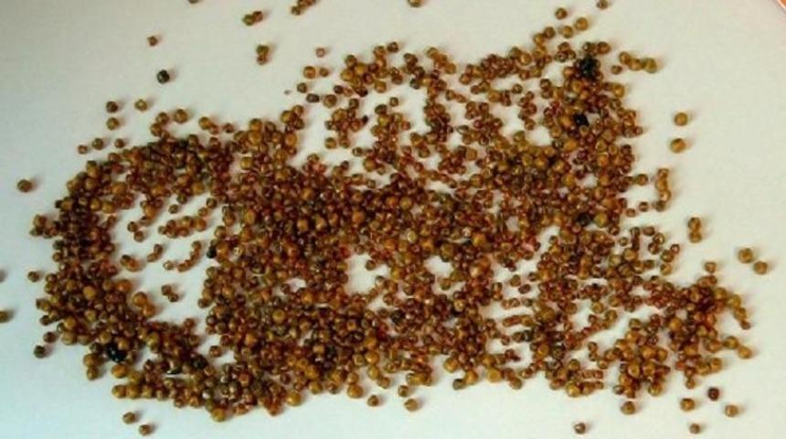 Safra kesesinden 1200 taş &ccedil;ıktı