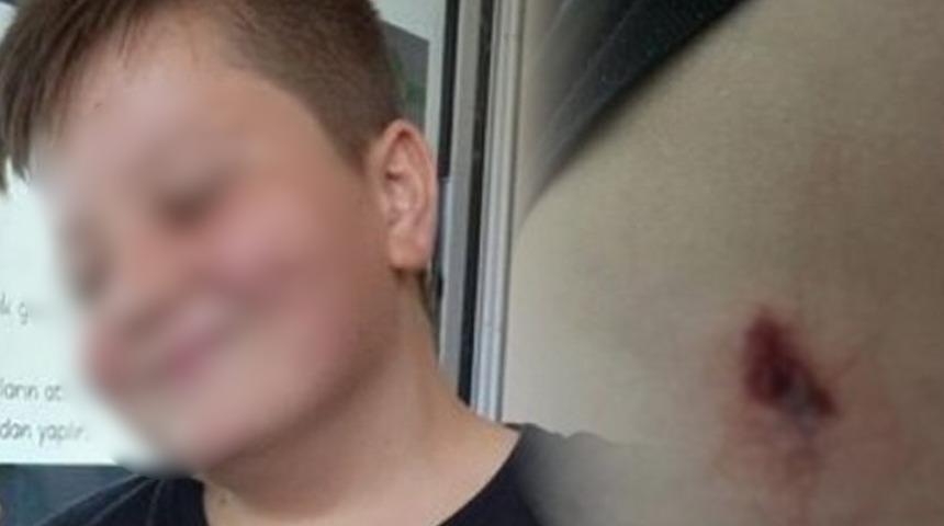 Denizli'de korkunç olay! Yorgun mermi 12 yaşındaki Adem'e isabet etti