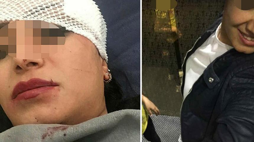 Son dakika: Konya'da jiletli dehşet! Sevgilisinin yanında gördüğü kadına kâbusu yaşattı! "Elimdeki jileti unutmuşum"