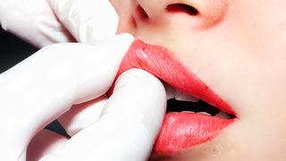 Yaptırmadan önce bir kez daha düşüneceksiniz! Dudağa enjekte edilen dolgu gerçekte nasıl görünüyor?