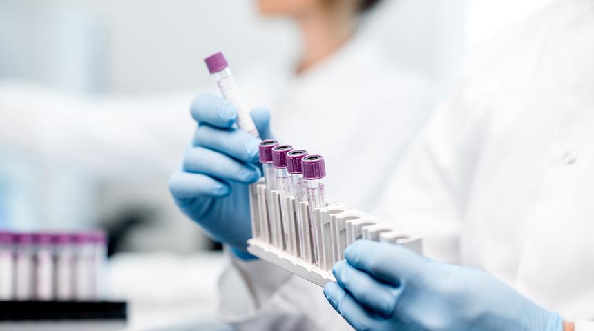 Sigara içmeseniz bile dumanını solumanız kanser riskinizi arttırıyor!