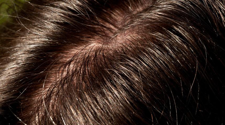 Bir tek siz yaşamıyorsunuz! Saçlarınız çabuk yağlanıyorsa bunları yapmayı hemen bırakın