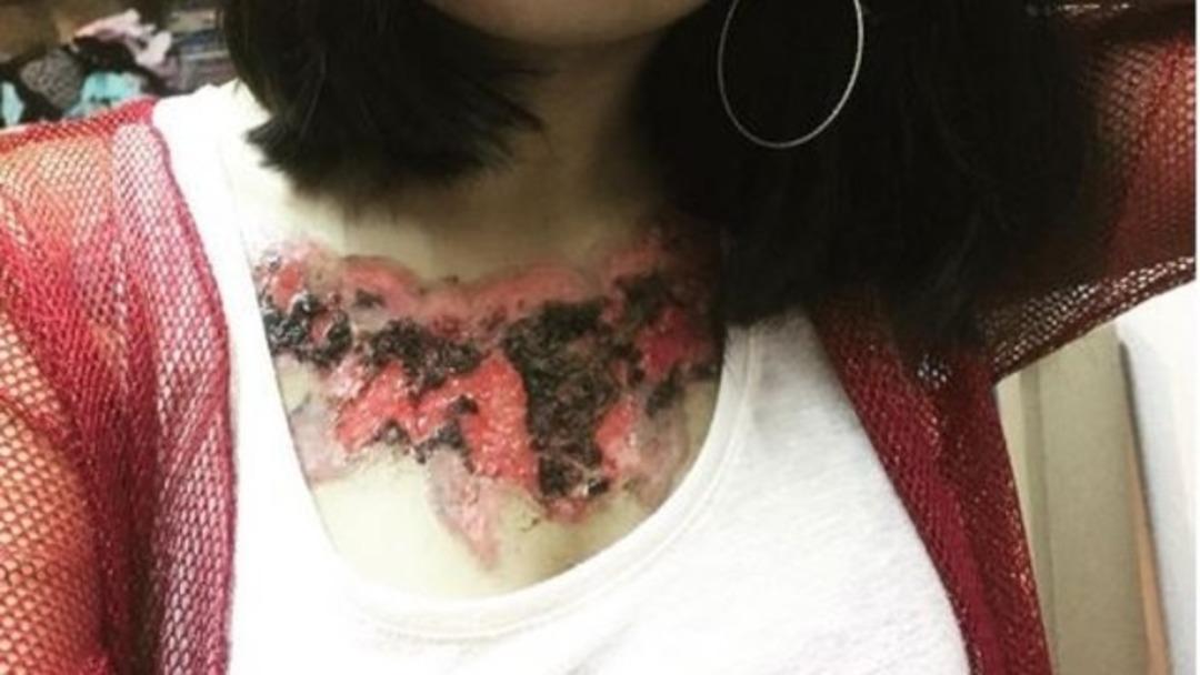 D&ouml;vmeyi sildirince bu hale geldi (+18)