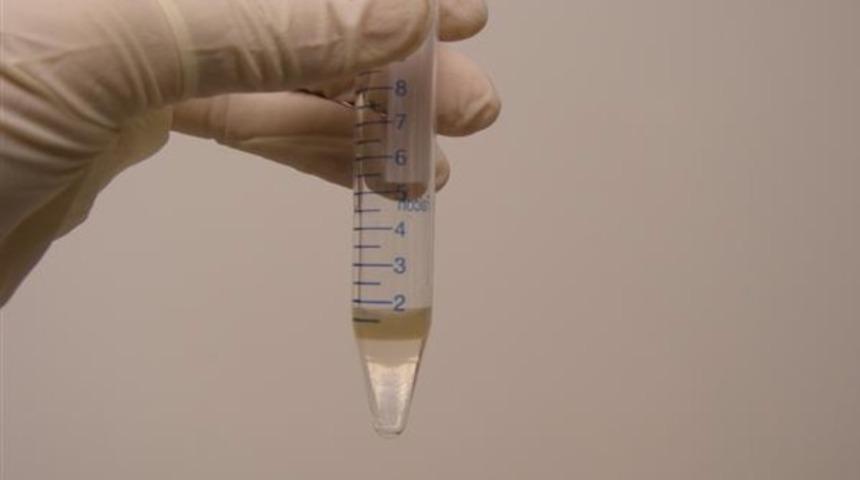 Hücre hasar testi yaptırdınız mı? 