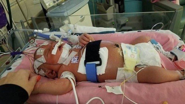 18 günlük bebek bir öpücük yüzünden yaşamını yitirdi