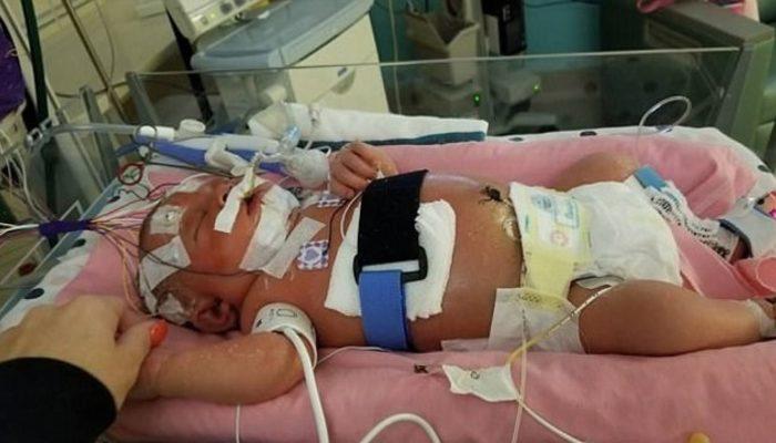 18 günlük bebek bir öpücük yüzünden yaşamını yitirdi