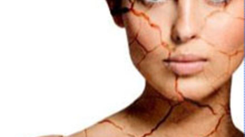 Cilt Kuruluğunu &Ouml;nleyin