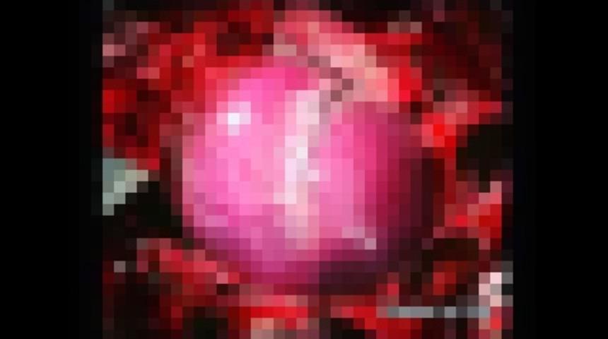 Kokain Kullandıktan Sonra İnsan Kalbi Nasıl Görünüyor?