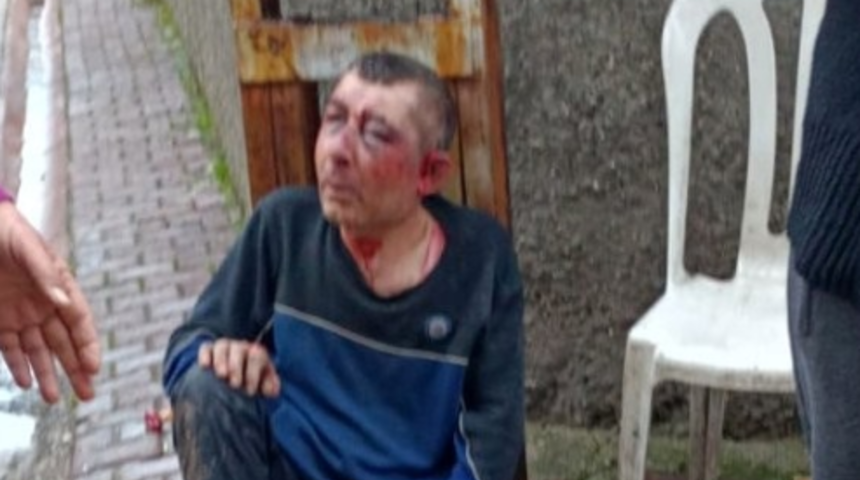 Adana'da fırın sahibi fırın çalışanını öldüresiye dövdü! Karısı tanıyamadı: Bu benim eşim mi?