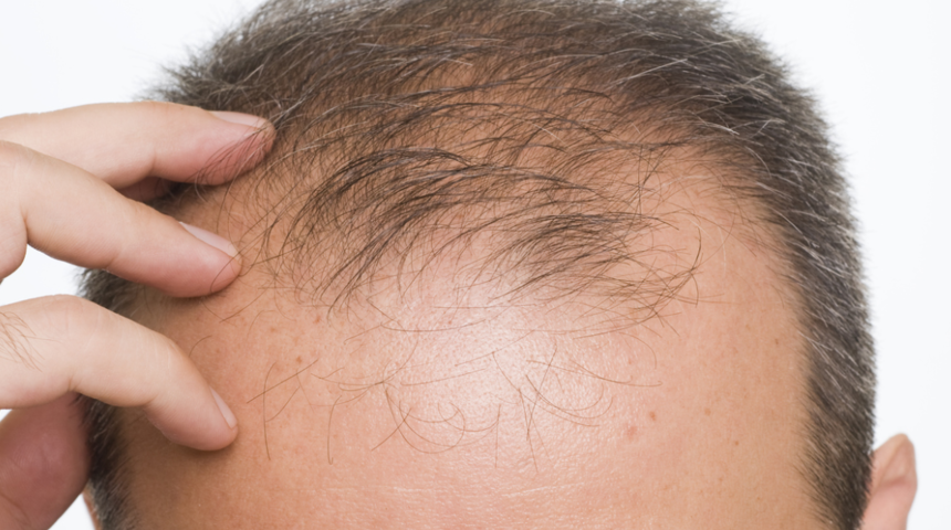 Samsun Büyükşehir Belediyesi'ni arayıp bunu soruyorlar: Kel ilacı yardımınız var mı?