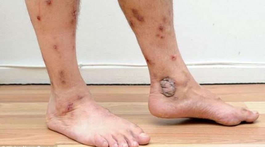 İnternetten aldığı koltuk zehirledi